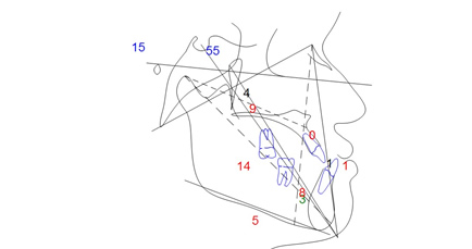 cirurgia-ortognatica-3.jpg