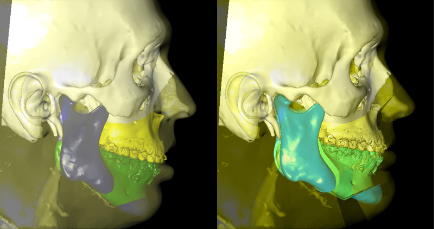 cirurgia-ortognatica-5.jpg