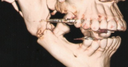 trauma-face-2.jpg